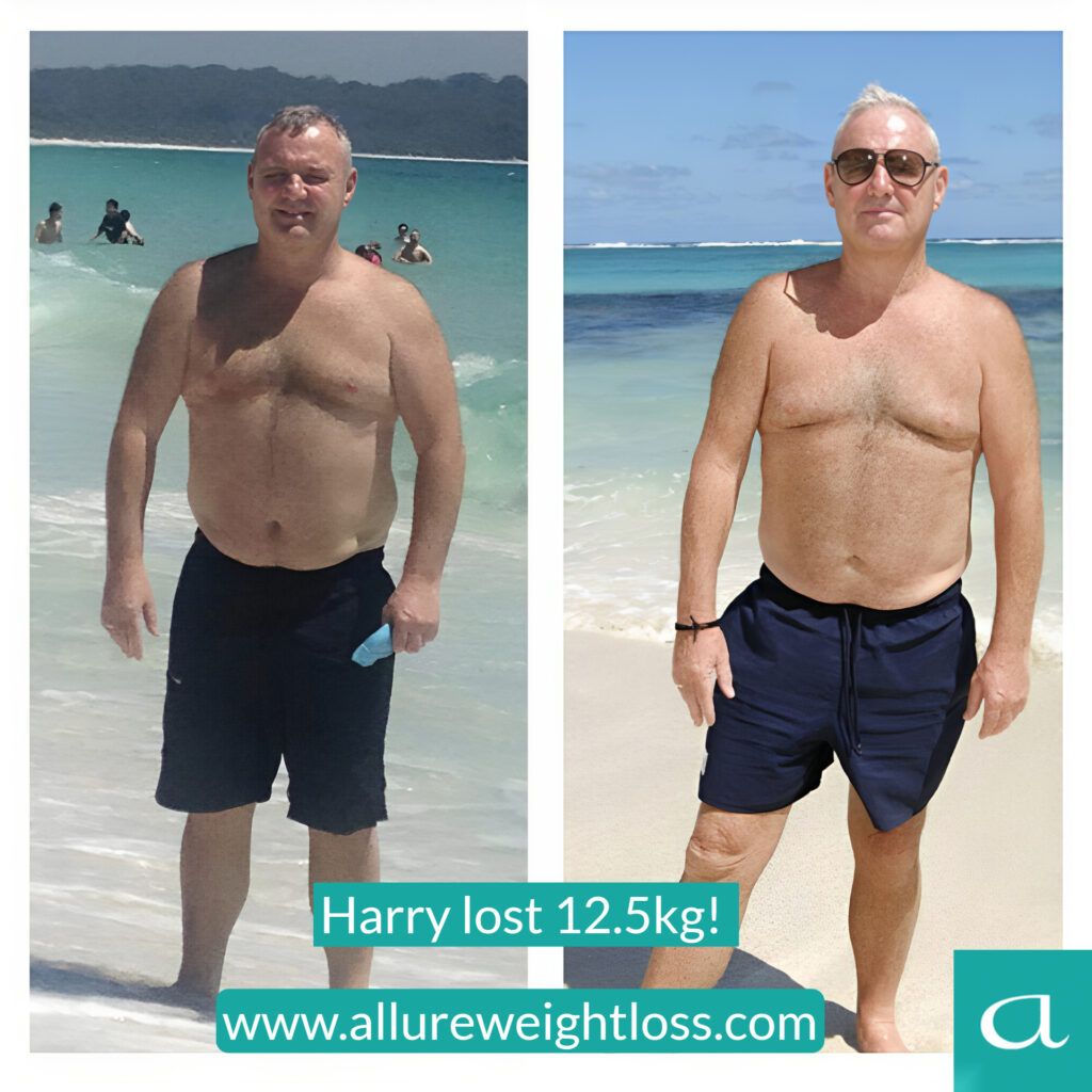 Before and after photos of a man who has undergone weight loss