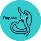 Bypass icon