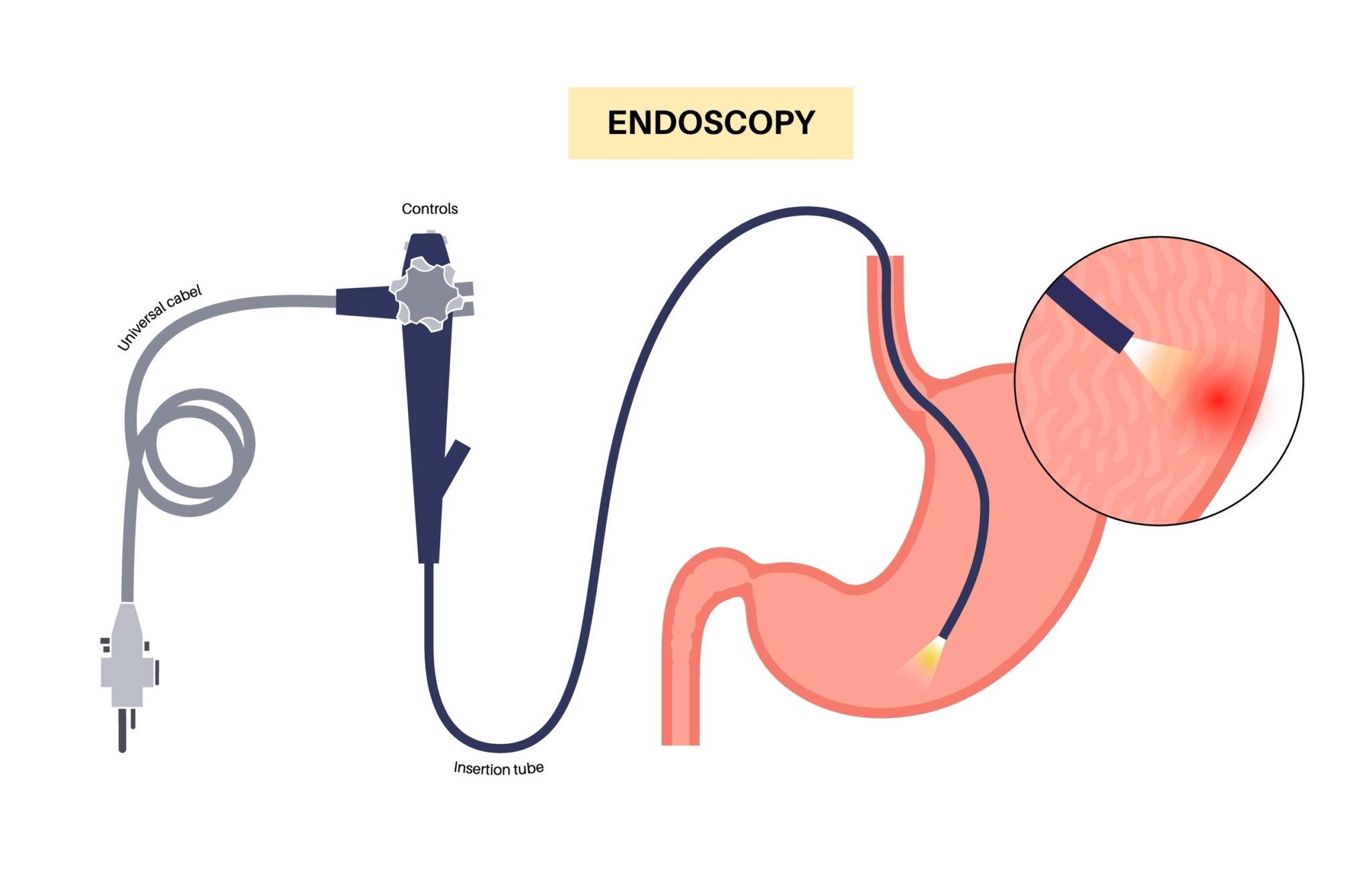 Image showing the process of an endoscopy